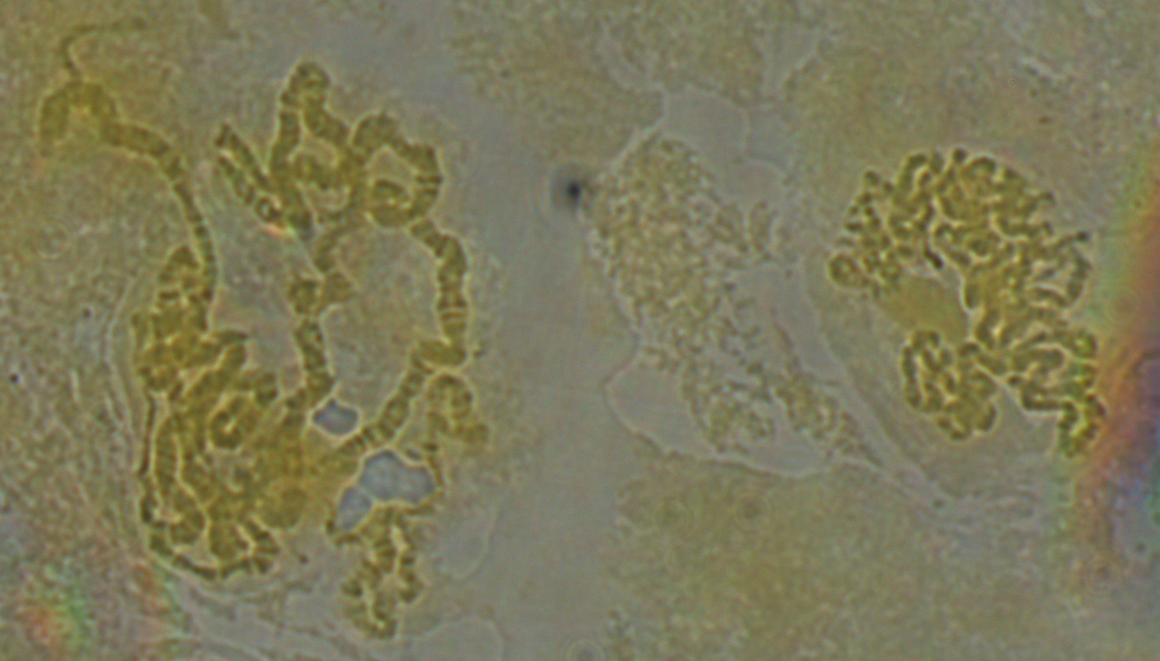 dmel-polytene-2014-07-28-12-03-43-chromosomes
